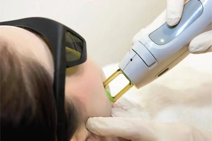 هوس التجميل… سباق بلا نهاية نحو وجه مثالي - 1000585328