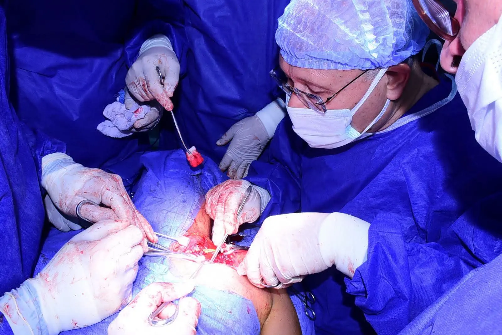 رئيس جامعة سوهاج يقود تدخلًا جراحيًا دقيقًا لإنقاذ طفل