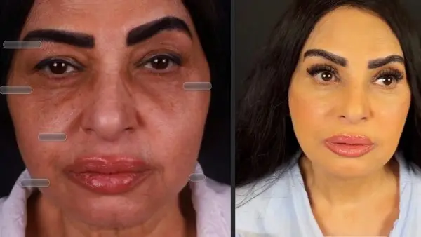 سلوى خطاب تتصدر تريند «جوجل» بعد أحدث ظهور لها.. هل خضعت لعمليات تجميل؟