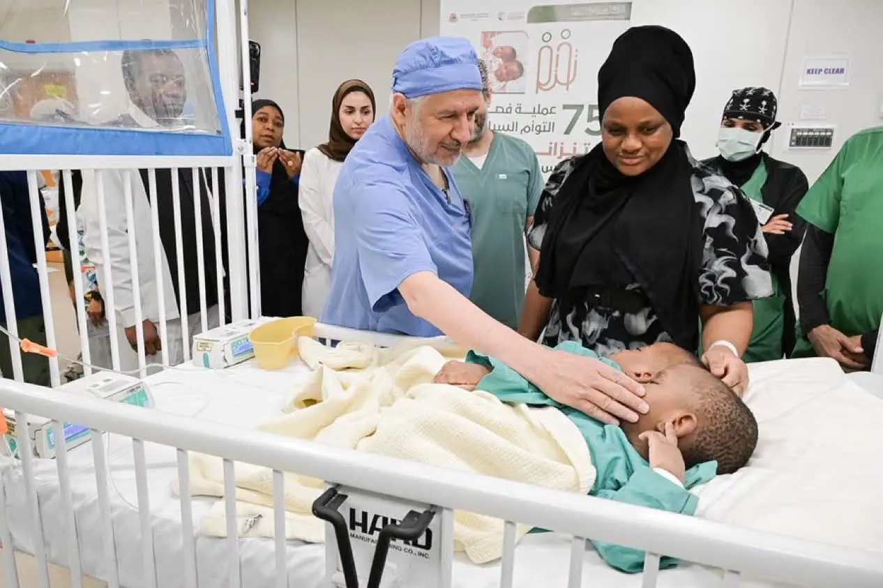 15 ساعة و44 مختصًا.. بدء عملية فصل التوأم التنزاني «لايتيينس ولوفنس» في الرياض