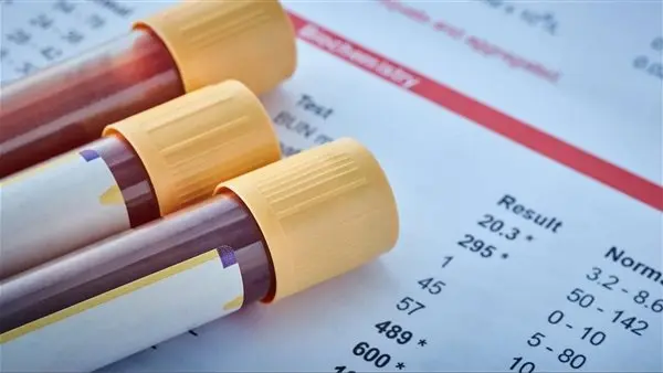 اختبار جديد يكشف تفاصيل أورام الدماغ خلال ساعتين