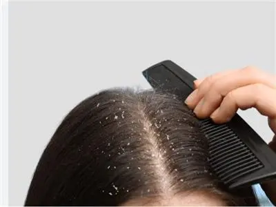 تنظيف فروة الرأس الخطوة الأساسية لشعر قوي