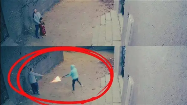 بتر قدم طفل ضحية واقعة باسوس بالقليوبية.. ووالده في حالة حرجة