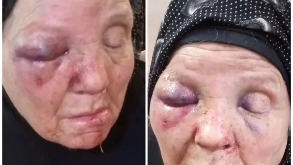 القصة الكاملة لمأساة "دمنهور الوحش".. كيف نكل "ابن عاق" بوالدته في زفتى من أجل المخدرات؟