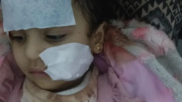 فاجعة في السيرك القومي.. "شبل" يهاجم طفلة بالعجوزة ووالدتها تكشف تفاصيل صادمة