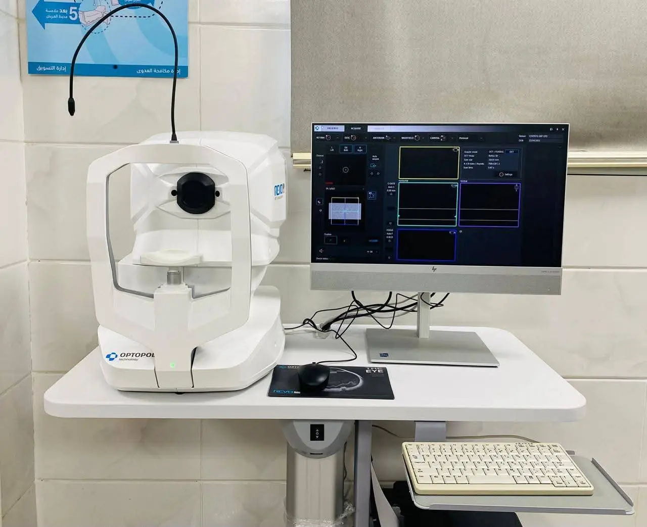 الرعاية الصحية: تشغيل أحدث  جهاز OCT Angiography لتصوير شبكية العين بمستشفى الرمد التخصصي ببورسعيد