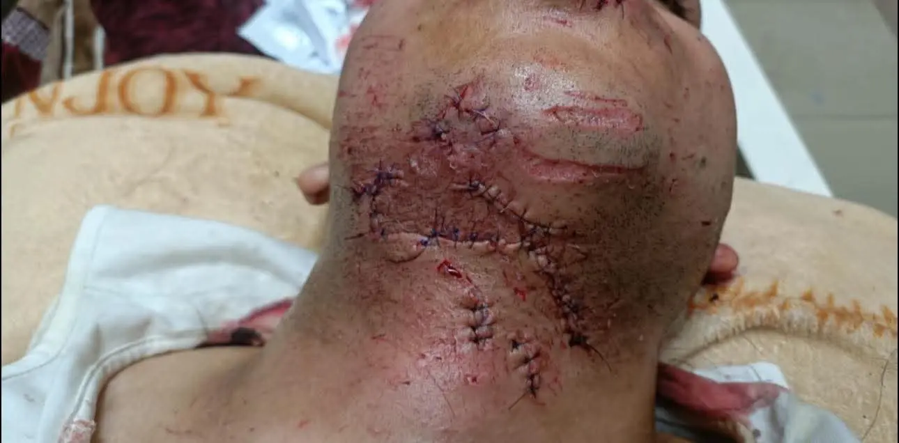 إنقاذ شاب من الموت المحقق بسوهاج.. تدخل جراحي عاجل يوقف نزيفًا حادًا بالرقبة