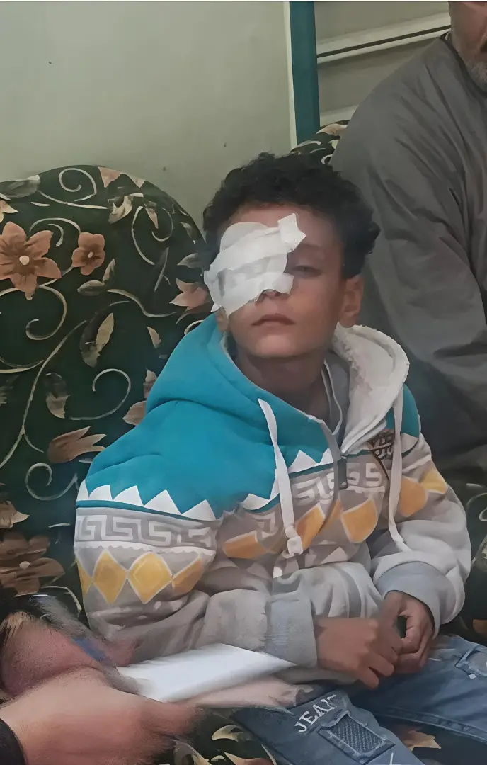 الحبس 3 سنوات لمعلمة تسببت في فقدان تلميذ عينه داخل مدرسة بقنا