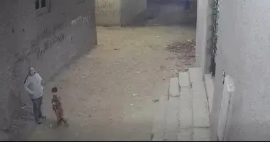 الصحة تكشف حقيقة بتر قدم طفل القليوبية