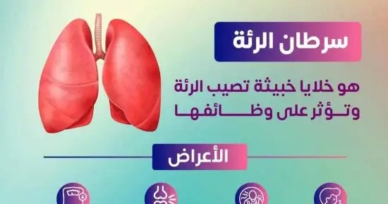 4  أعراض تستدعي الانتباه.. الصحة تكشف علامات قد ترتبط بسرطان الرئة