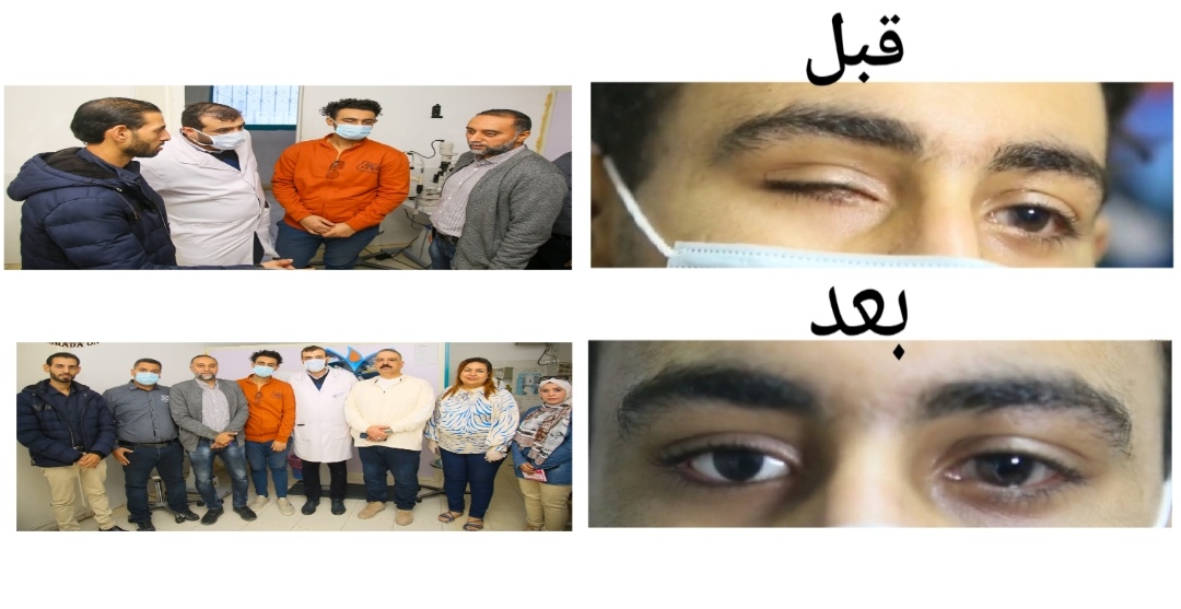 تركيب عين صناعية متحركة لمريض بمستشفى الغردقة العام  