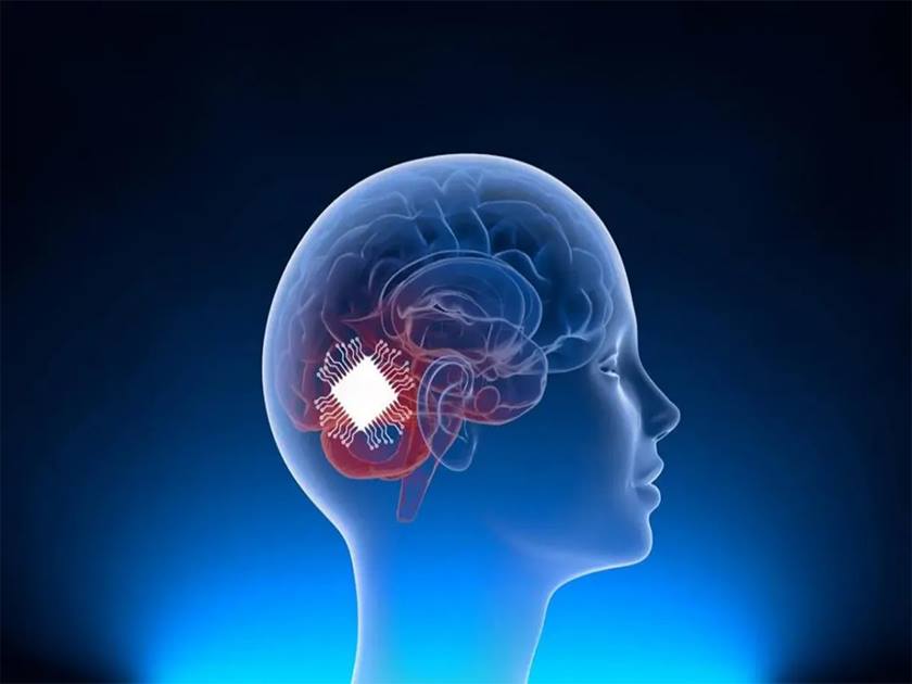 بعد خضوع أول مريض لزراعة شريحة دماغية .. إلى أين تمضي البشرية؟