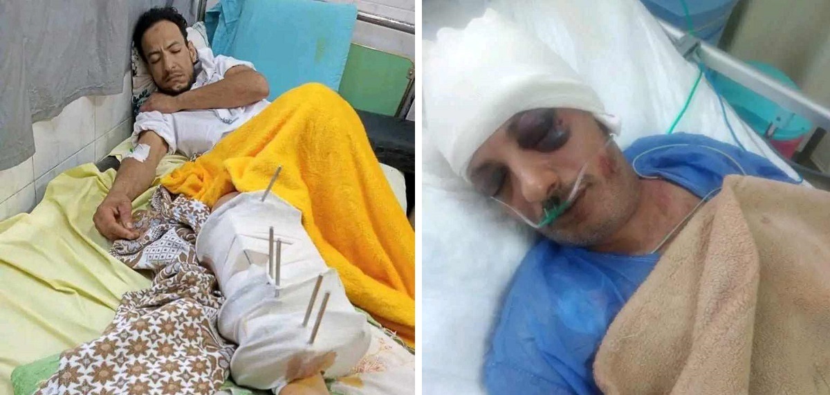 نجاة شابين من الموت بالشرقية ..سقطت عليهما سيدة