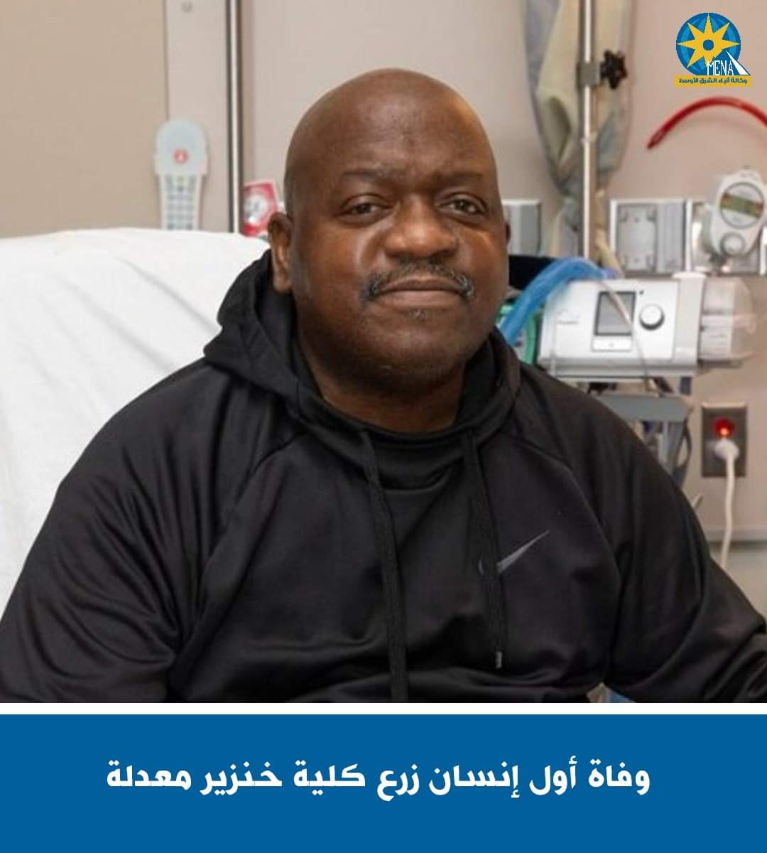 وفاة أول شخص خضع لعملية زرع كلية خنزير معدلة وراثيا
