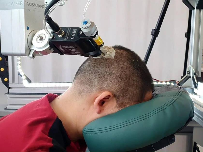 علماء يخترعون حبرا سائلا .. يمكّن الأطباء من قياس نشاط الدماغ بدقة