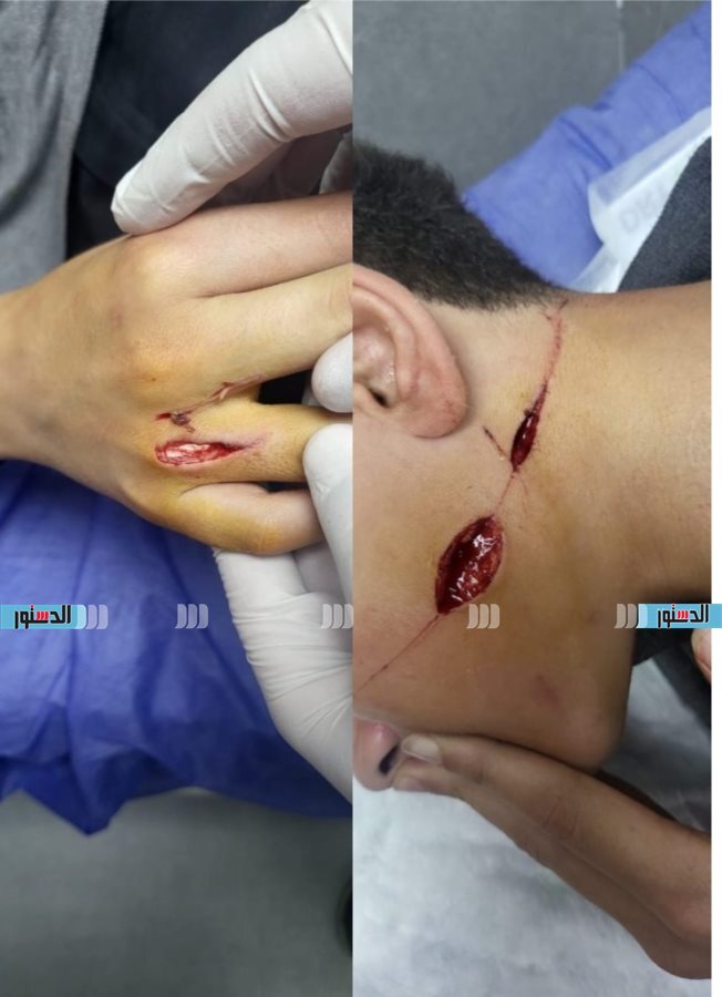 طالب بالبحر الأحمر كاد يفقد حياته بسبب وسامته