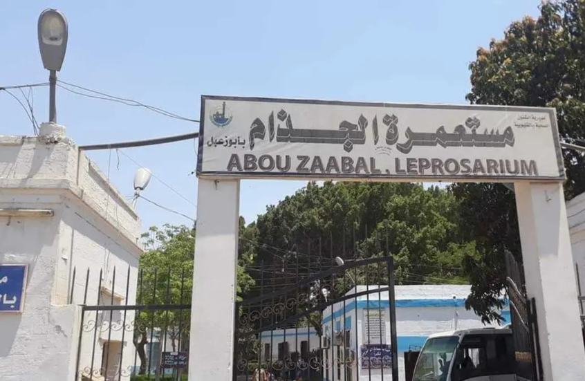 الصحة تنفى عزمها غلق مستعمرة الجذام