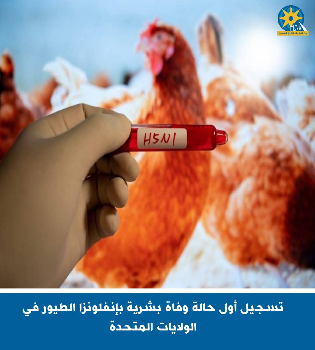 تسجيل أول حالة وفاة بشرية بإنفلونزا الطيور فى أمريكا