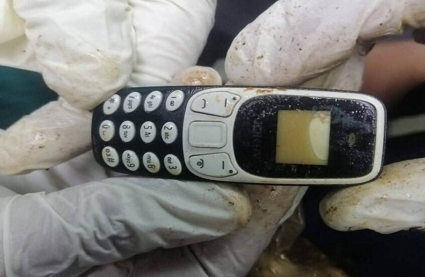 استخراج محمول من بطن شاب ابتلعه منذ عامين.. بدون جراحة