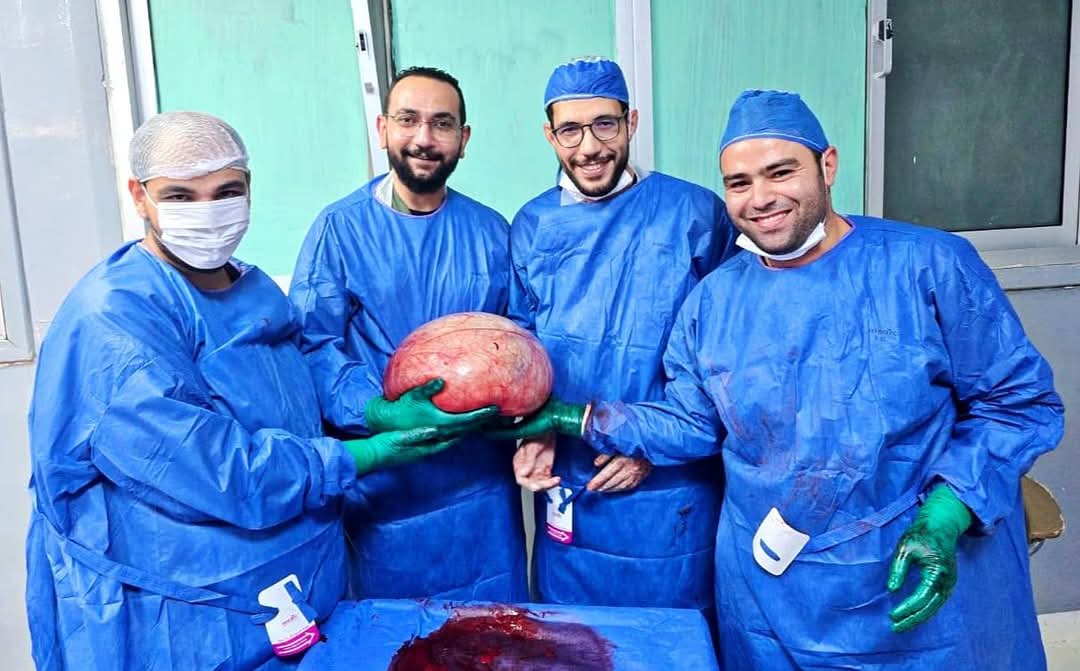 نجاح طبي  بمستشفى الفيوم العام: استئصال ورم ضخم يزن أكثر من 15 كجم من فتاة عشرينية