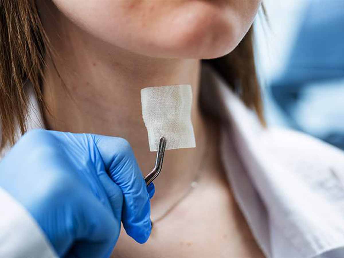 ابتكار بواسطة «طابعة ثلاثية» .. لتجديد الحنجرة لدى مرضى السرطان