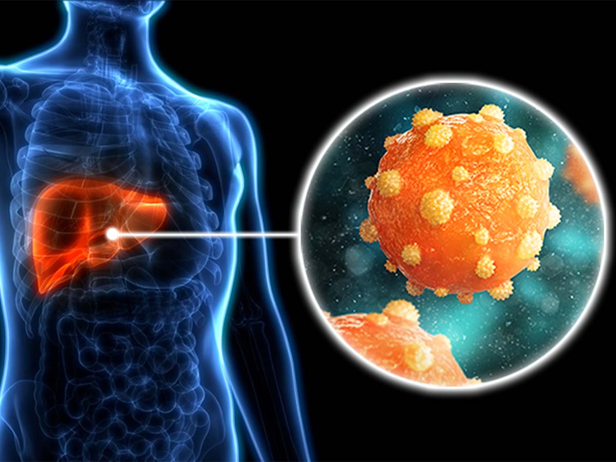 دراسة ألمانية تؤكد خطورة فيروس «التهاب الكبد E» .. لمهاجمته خلايا الكلى - الخبر لايف