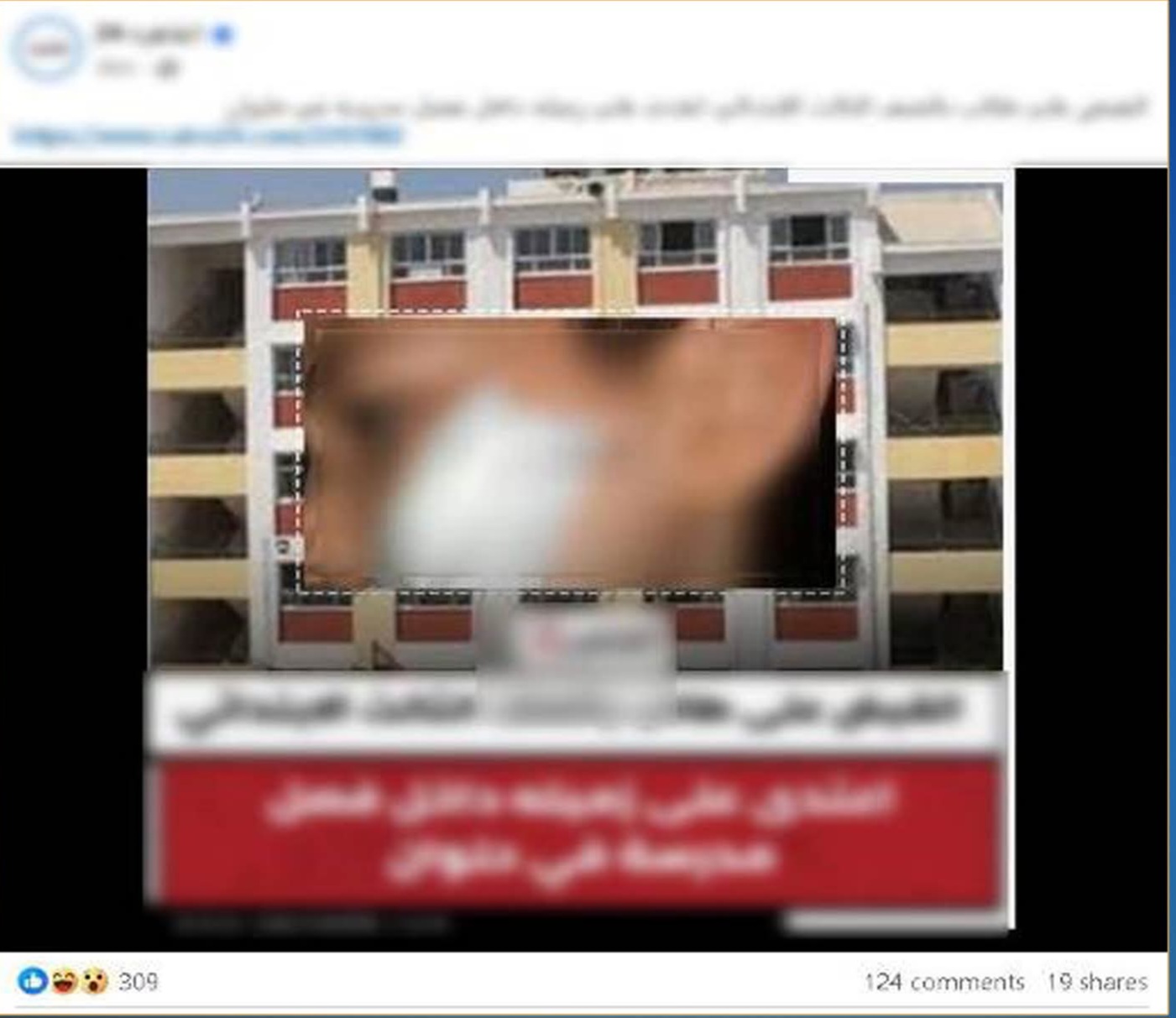 جرح صغير.. وشائعة كبيرة! ما الذي حدث داخل مدرسة حلوان؟