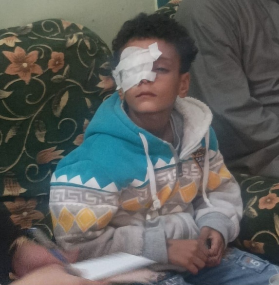 توجيه عاجل من محافظ قنا بشأن طفل فقد عينه بالمدرسة