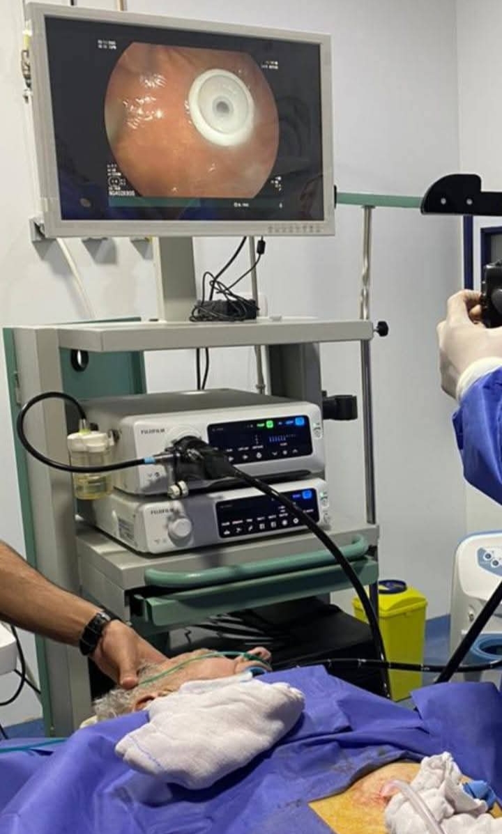 لأول مرة بمستشفي إدكو ..تركيب أنبوب تغذية بالمعدة بواسطة منظار الجهاز الهضمي 