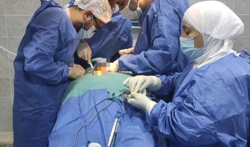 الفريق الطبي بمستشفى رشيد المركزى ينجح فى إجراء جراحتين متقدمتين لحالتين سمنة مفرطة